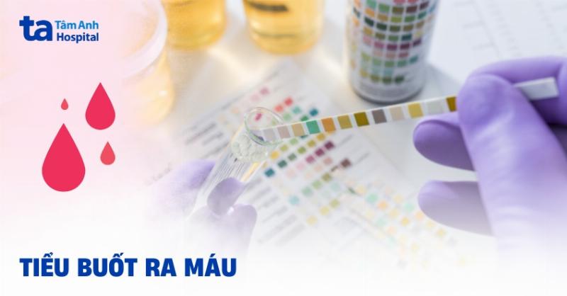 Các nguyên nhân khoa học gây nóng tai phải nữ và khi nào cần đi khám bác sĩ